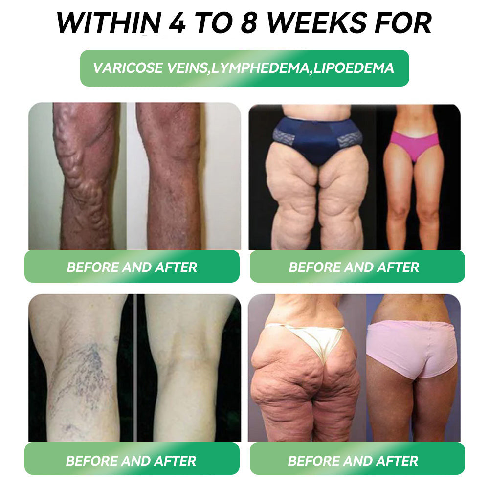 Only 10 boxes left! โฐ Score an exclusive 30% off today!  Endorsed by endocrinologists โ 4 to 6 boxes recommended to keep the weight off and avoid rebound.  Last chance before the new year rolls around โ donโt miss out! ๐ฅ
